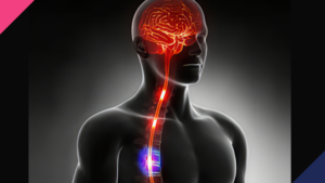 Autonomic Dysreflexia3 | Abuka