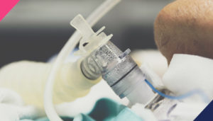 tracheostomy | Abuka