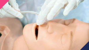 Nasogastric Feeding Insertion | Abuka