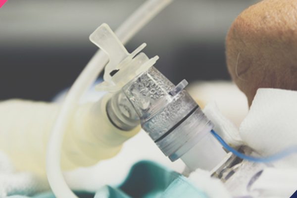 tracheostomy